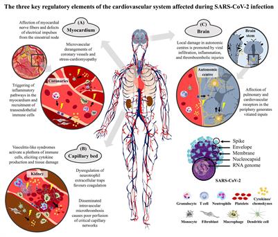 SARS-CoV-2 Aiming for the Heart: A Multicenter Italian Perspective About Cardiovascular Issues in COVID-19